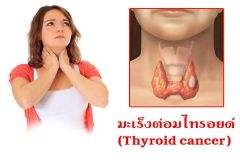 Thyroid02